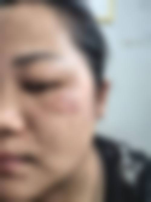 铜仁瑞丽整形医疗美容诊所真人口碑评价怎么样?