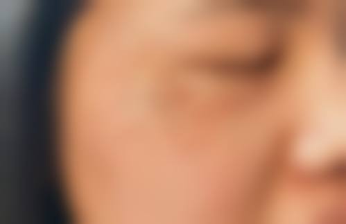 李懋医生口碑评价及真人实例