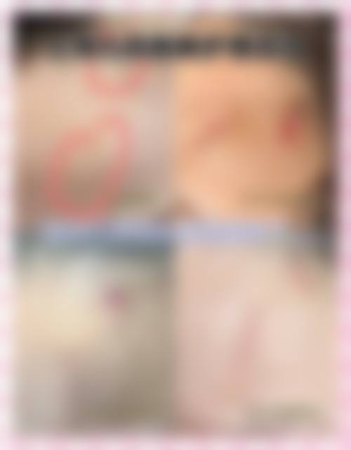 上海薇琳植发收费价格表/收费标准