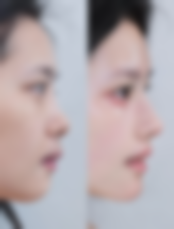 乐山人民医院美容科收费标准|价目表，涵盖医美手术与皮肤美容项目，如重睑术2700元起 