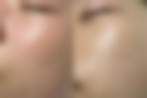 七、吉大二院激光脱毛的服务体验