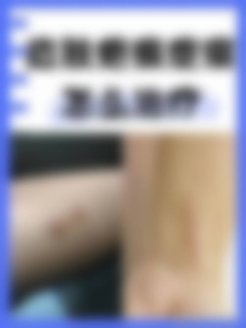 选择正规机构进行烧伤疤痕修复的重要性