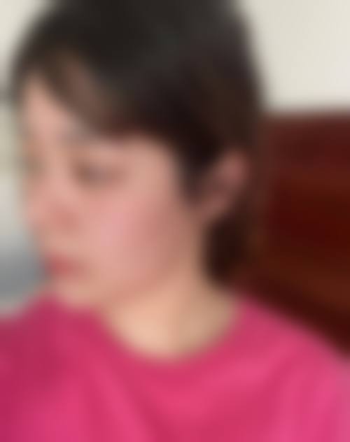 整形项目选择建议
