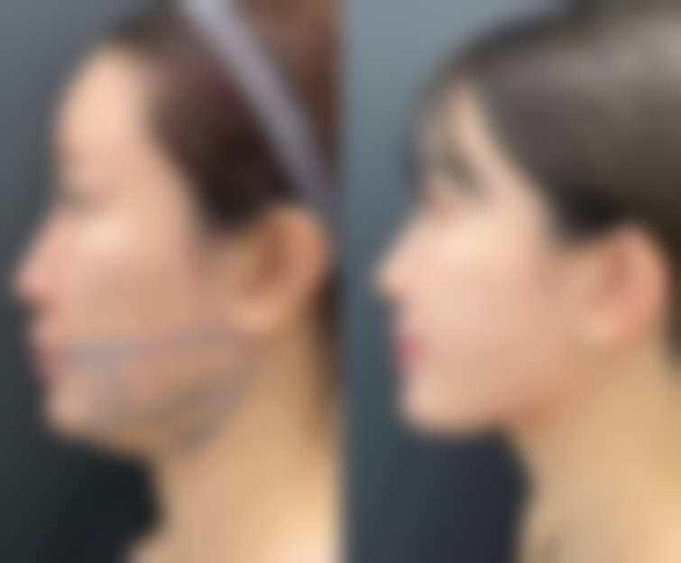 北京妙美肤殿堂爱美神整形医院怎么预约?