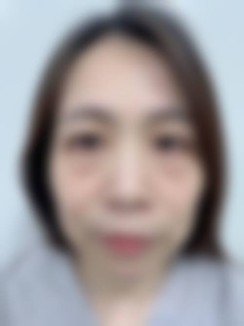 局部护理,呵护眼周肌肤
