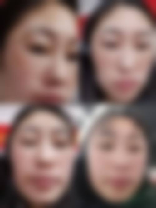 【广州皇佳贝利医学整形美容预约挂号方式】