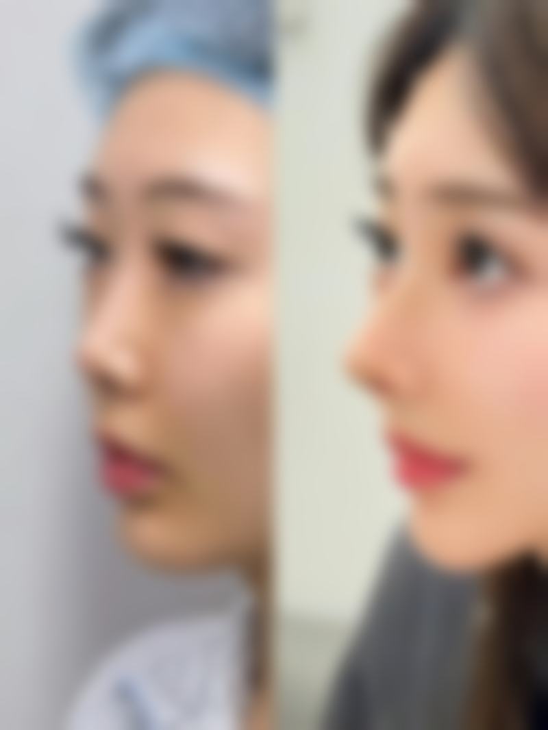 刘玉辉的医美成就