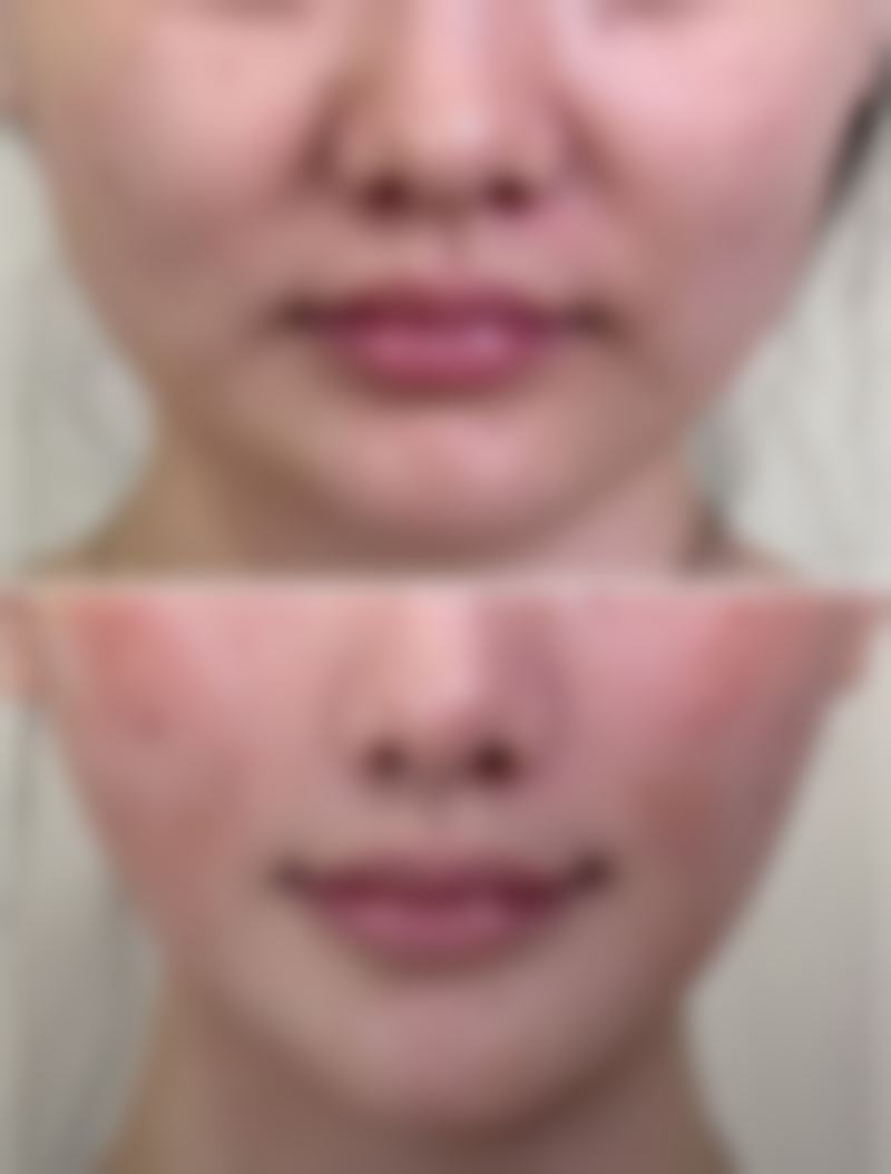 想知道西安西京医院整形美容科怎么样？看这篇，技术权威、项目全，闭眼入！ 