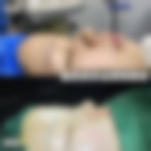 二、西 南医院美容整形科眼部整形价格优势