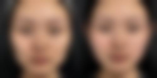 圣心医美 新潟院常见问题解答