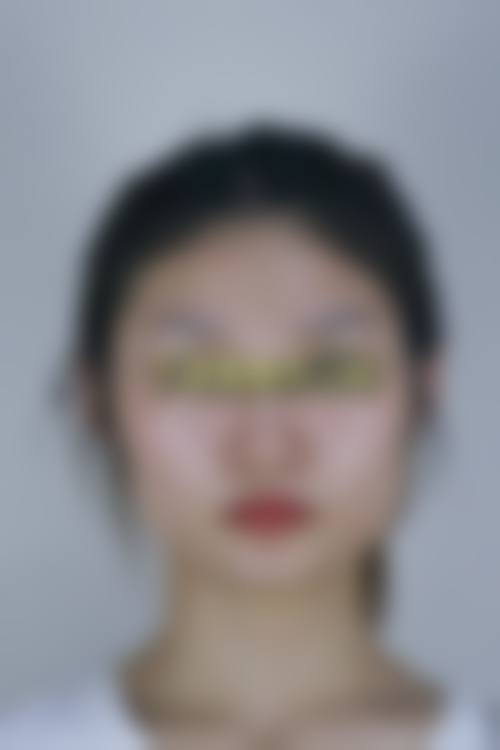 三、上海时光下颌角整形的成效自然吗？