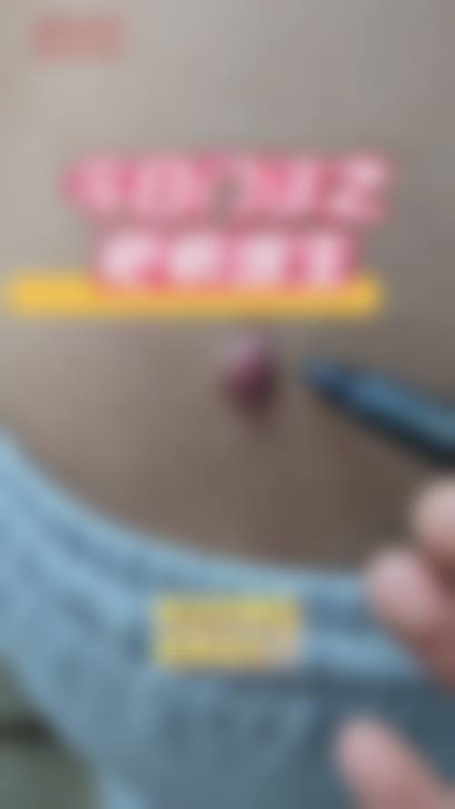 常见的疤痕增生治疗方法