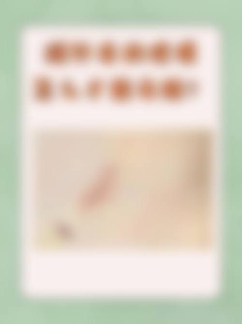 疤痕体质的疤痕治疗医生介绍