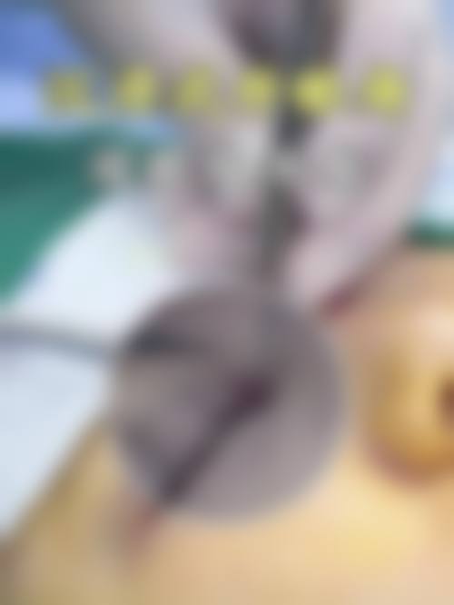 术后护理与修复过程