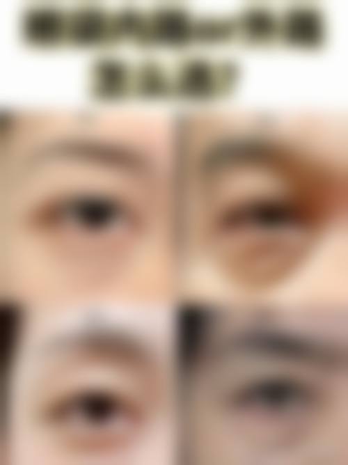 眼部按摩辅助