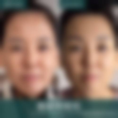 大连爱丁医疗美容预约挂号:多渠道便捷流程