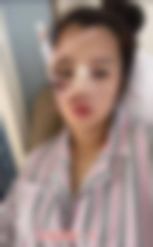 正定县睿恩美医疗美容门诊部价目表