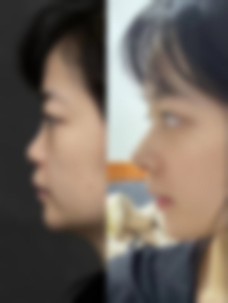 正定县睿恩美医疗美容门诊部口碑怎么样?