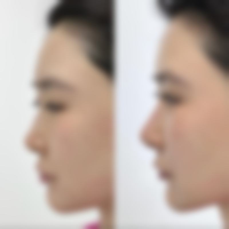 石家庄蓝山整形美容
