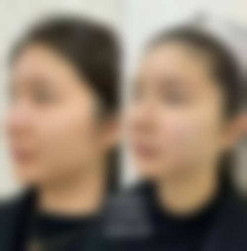 韩国SONE整形外科常见项目收费参考价格表