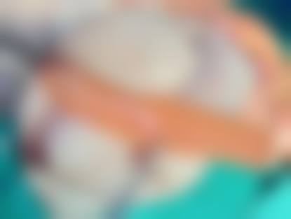 胸部干瘪下垂:外观改变的困扰