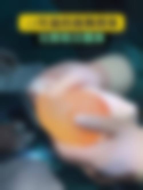 隆胸假体取出会有什么后果？可能出现假体残留、胸壁畸形等，做好护理可降低风险！ 