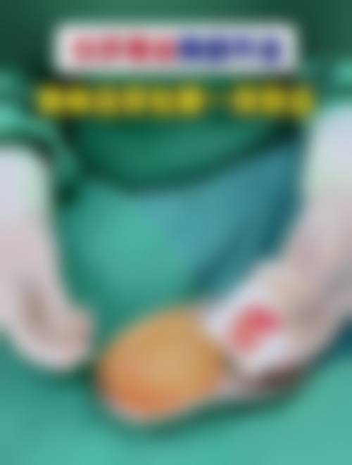 胸壁畸形:胸部形态的改变