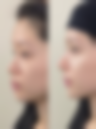 秦皇岛花之吻医疗美容诊所如何预约？