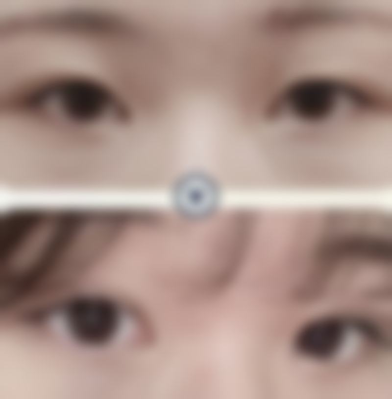 韩国眼部与鼻部整形特色医院
