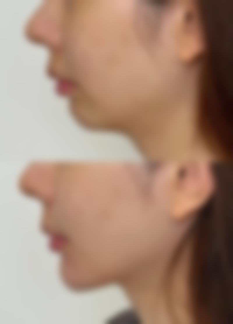 于冬梅医生解析手术麻醉与修复