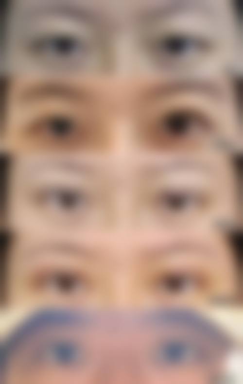 综合实力担当:广州普瑞眼科医院