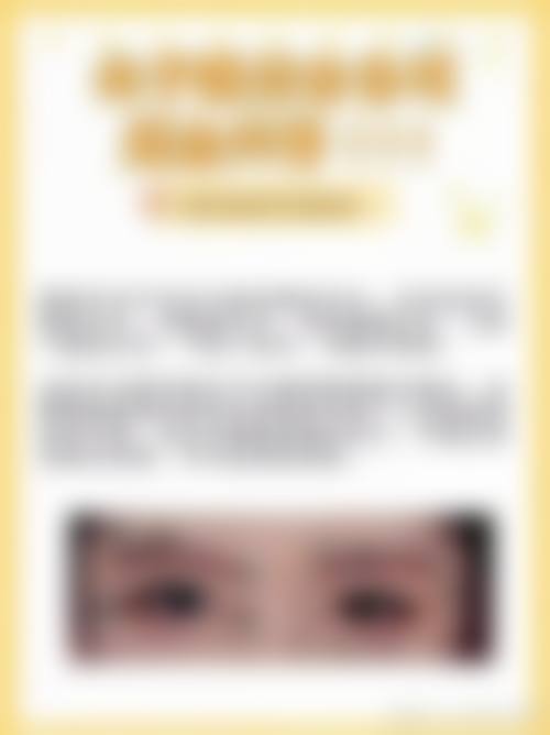 广州哪家医院做眼综合比较好？中山大学中山眼科中心、广州美莱等值得考虑！ 