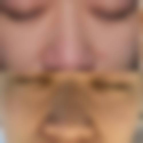 周林英医生技术优势