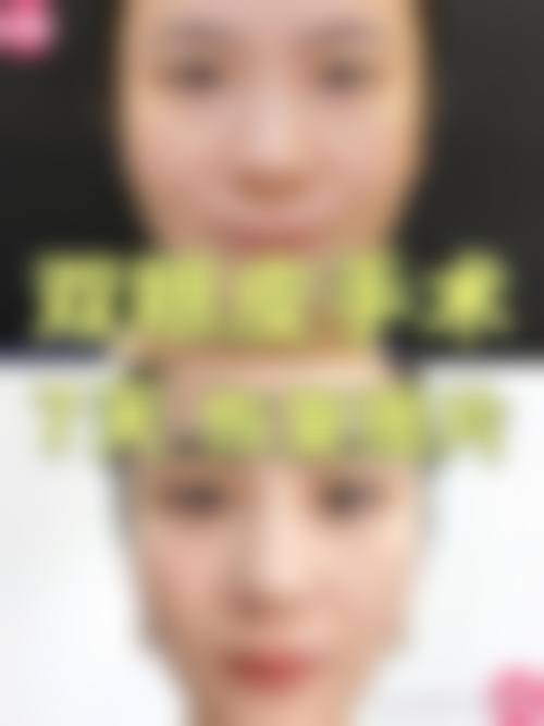 二、六安市人民医院整形科的项目优势