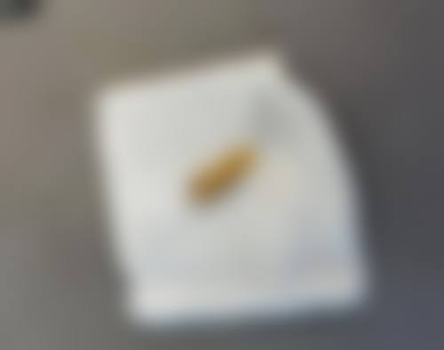 上海王洪医生整形资质正规！双证可查，内窥镜面部提升次日能买菜，取异物成功率98% 