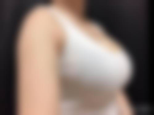 安徽阜阳微悦医疗美容医院:优质服务,成就美丽梦想