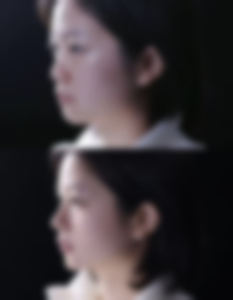 西安未央安尔美医疗美容诊所常见项目收费参考价格表