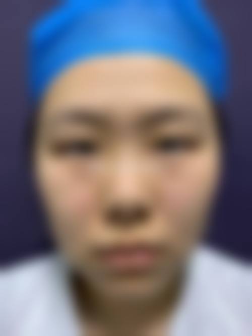 闫咏梅医生怎么预约?