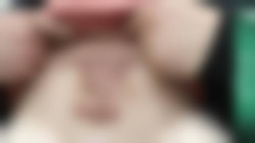 疤痕疙瘩修复的实例与经验分享