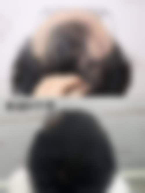 闫咏梅医生收费贵吗?