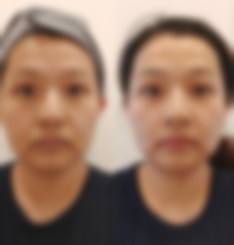 韩国Stanley皮肤科特色项目有哪些？
