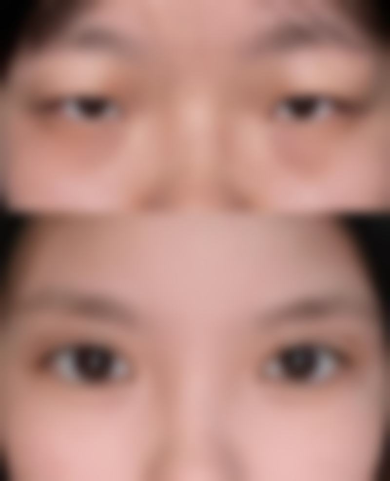 宜春爱思特整形医院真人口碑评价怎么样?