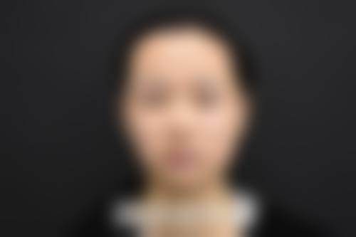 成都高亮医生个人资料简介：坐诊东篱医院，擅初眼与修复，价格透明案例惊艳！ 