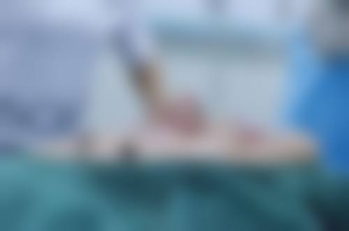 深圳美加美医疗美容医院价格表：双眼皮低至 888 元，周国伟院长技术靠谱！ 
