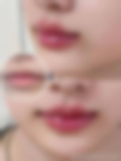 五、特色项目:昆明博美医疗美容医院的拿手好戏?