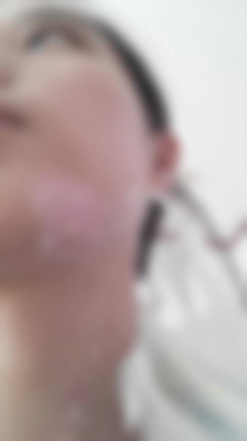 广州曙光疤痕修复中 心的自研技术好吗