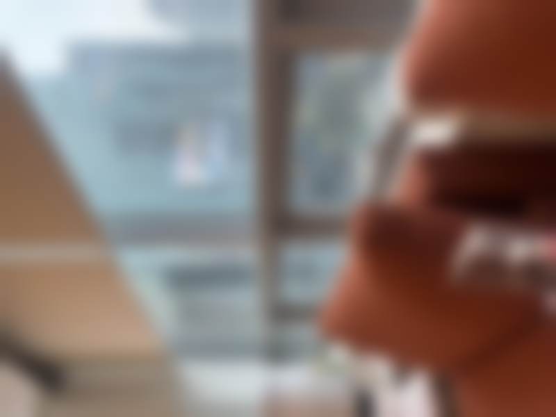 韩国slim edition吸脂医院手臂修复手术评价及核心内容真人案例分享，揭秘术后消肿快、线条美且无反弹的神奇效果！ 