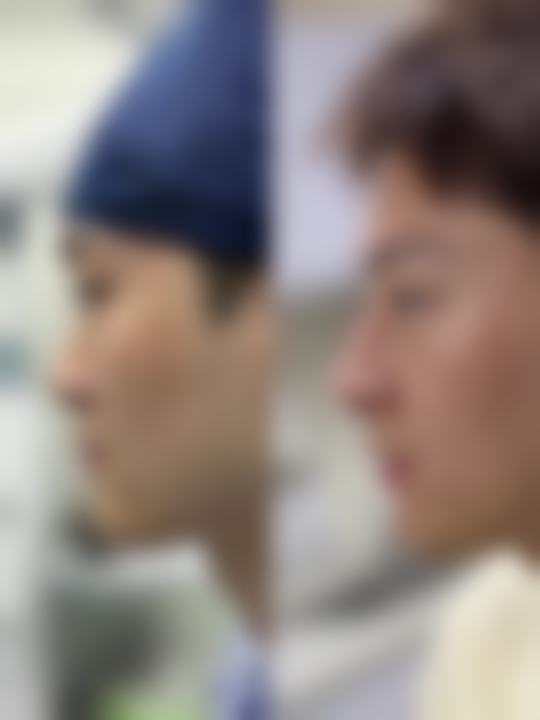 北京整形八大处眼部项目,价格与特色
