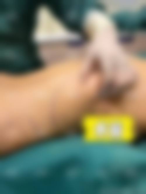 杭州耀然整形医院患者口碑:真实评价+体验细节