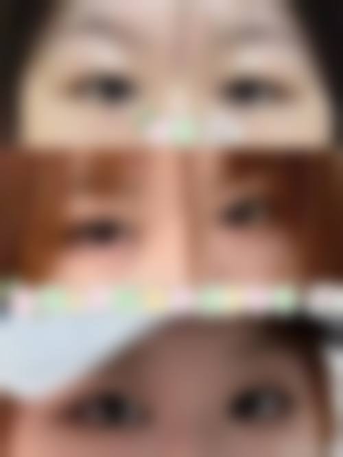 口碑服务:优质贴心的医美体验
